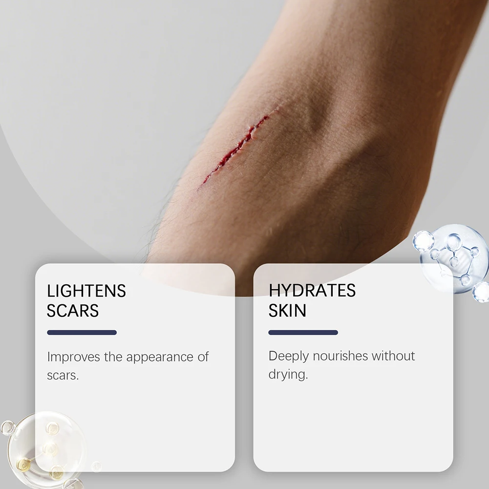 Silicone Sticks For Scars Gentle Safe For All Skin Types For Daily Use - Image 5