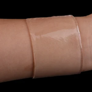 **1PC Scar Therapy Remove Trauma Burn Silicon Patch Reusable Acne Gel Skin Repair New